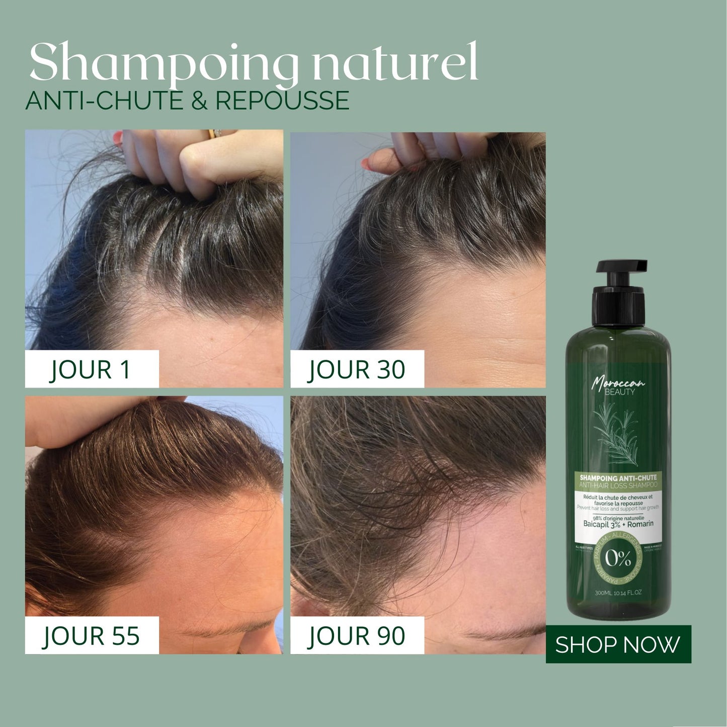 Natural Anti-Hair Loss & Hair Regrowth Shampoo – 3% Baicapil + Rosemary | 300 ml